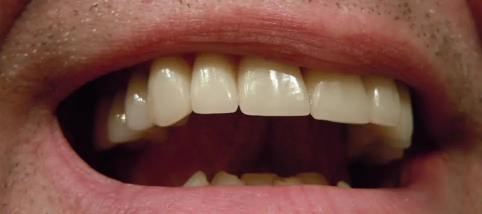 close up of a man's smile